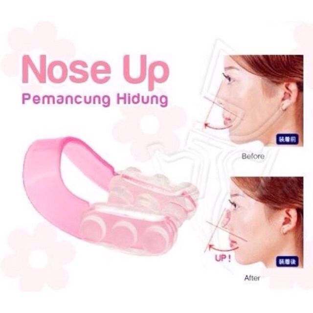 Kẹp nâng mũi Nose Up