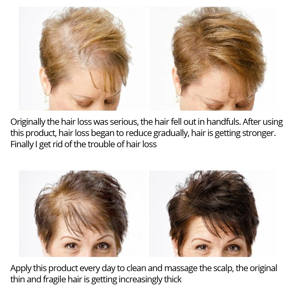 Tinh chất xịt VIBRANT GLAMOUR ngăn rụng tóc 30ml | BigBuy360 - bigbuy360.vn