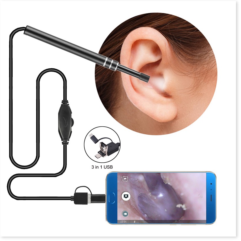 Camera Nội Soi Lấy Ráy Tai ✔️Chính Hãng✔️ 3 trong 1 có đèn LED, Nội Soi Tai Mũi Họng, Có Kết Nối Với Điện Thoại, Máy Tín