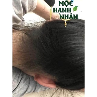 Xịt Kích Thích Mọc Tóc Hạnh Nhân Tóc Dày Chắc Khỏe