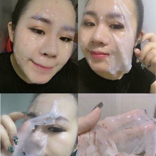 Mặt nạ hoa hồng collagen