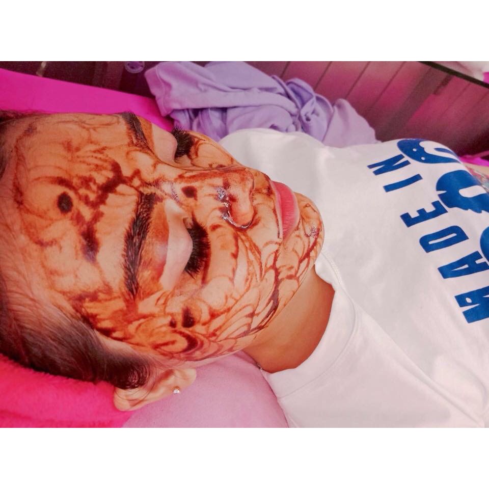 HCM  - Liệu trình căng bóng da: Cấy hồng sâm + Chiếu sáng sinh học + Điện di Vitamin C tại BEE Spa