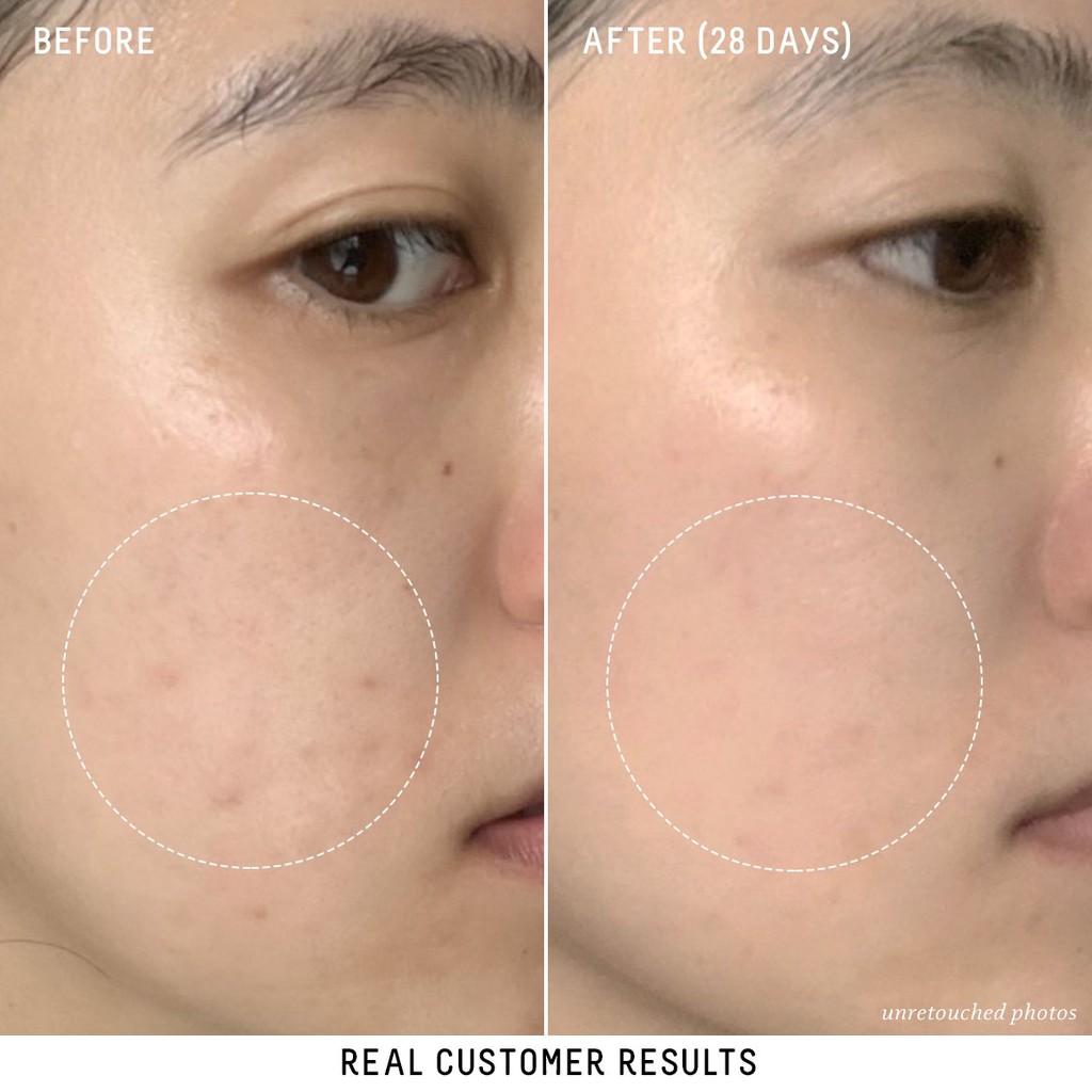 Tinh chất mờ thâm sáng da BIOSSANCE Squalane + 10% Vitamin C Dark Spot