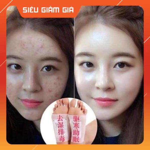 MIẾNG DÁN CHÂN THẢI ĐỘC NGẢI CỨU ĐÔNG Y (HỘP 50 MIẾNG) | BigBuy360 - bigbuy360.vn