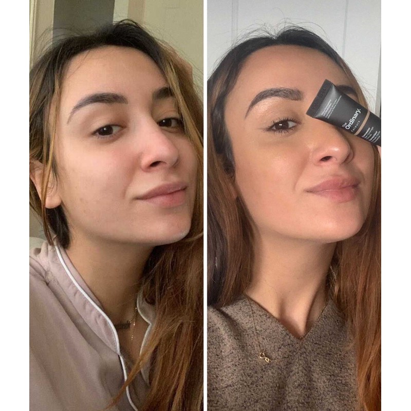 [TOP 1 UY TÍN] Kem Che Khuyết Điểm The Ordinary Concealer High Coverage Formula | BigBuy360 - bigbuy360.vn