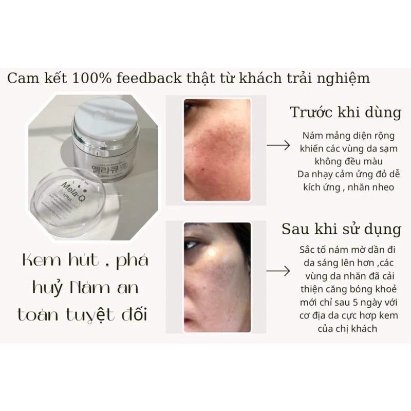 ( Chính Hãng Hỏa Tốc Sg ) Kem Mela-Q Cream Hàn Quốc dưỡng trắng, giảm các vết nám, tàn nhang hộp 50ml - CO120h