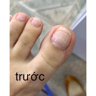 Dưỡng phục hồi móng tay chân CND 3,7ml