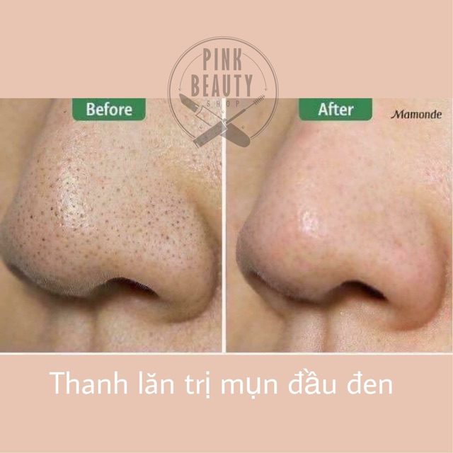 Thanh Lăn Trị Mụn Đầu Đen Mamonde Pore Clean Blackhead Stick | BigBuy360 - bigbuy360.vn