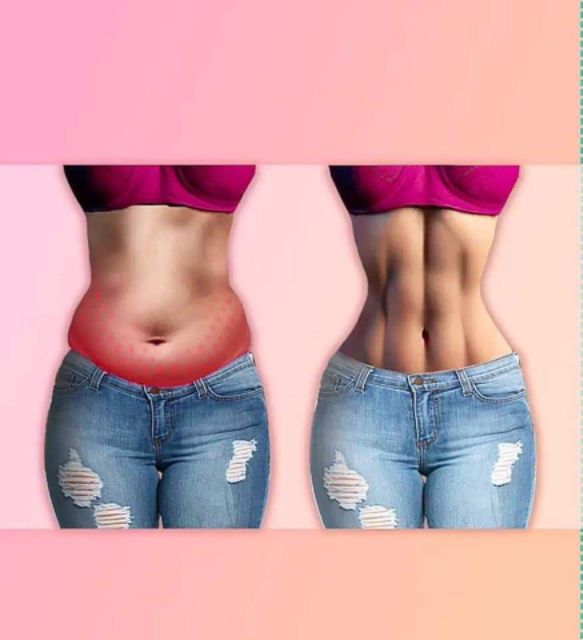 Đai nịt bụng 29cm 9 xương PERFECT LATEX