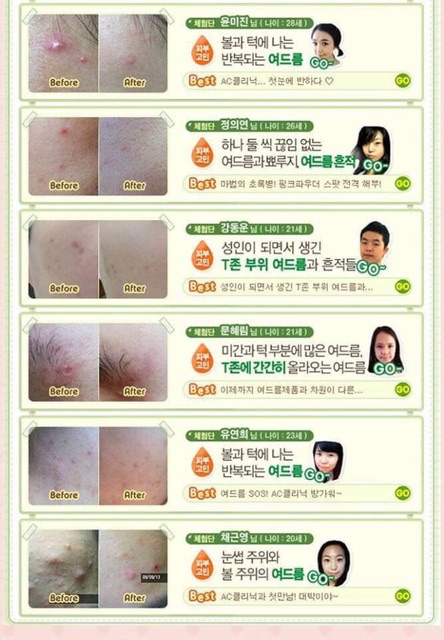 [Mẫu mới] Chấm mụn AC CLEAN UP PINK POWDER SPOT | BigBuy360 - bigbuy360.vn