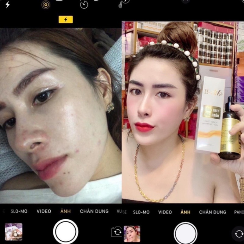 ⭐TÁI TẠO DA HỒNG SÂM⭐️CHÍNH HÃNG CÔNG TY