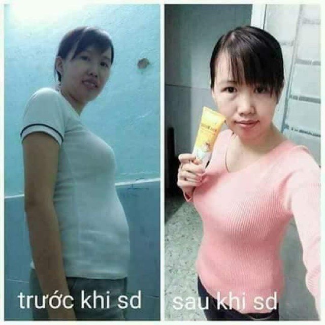 ( COMBO 2 LỌ _ Có tem QR Icheck_Chính hãng ) Kem massage tan mỡ gừng ớt Ngân Bình giảm cân, giảm mỡ bụng,đùi,eo,bắp tay