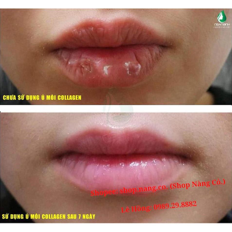 Ủ MÔI Collagen Ngân Bình 5g, Dưỡng MÔI KHÔ NỨT NẺ, Khử MÔI THÂM BONG TRÓC, LÀM HỒNG MÔI, HỒNG NHŨ HOA