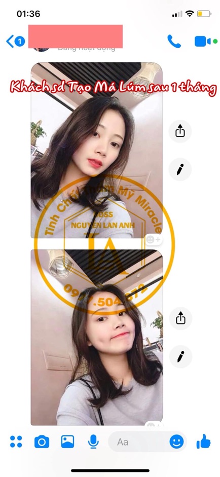 Tinh Chất Tạo Má Núm Đồng Tiền Miracle