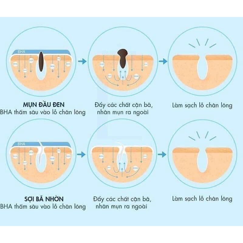 BHA 2% Obagi CLENZIDderm Pore Therapy | BigBuy360 - bigbuy360.vn