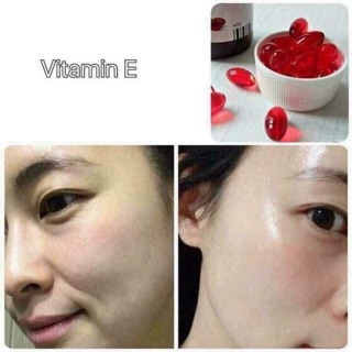 Vitamin E đỏ của Nga mẫu mới dạng vỉ