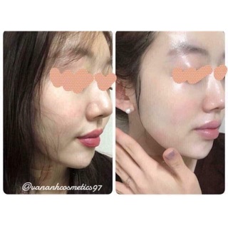 The Ordinary AHA 30% + BHA 2% Peeling Solution