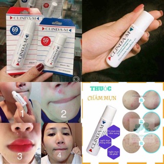 CHẤM MỤN CLINDA M THÁI LAN
