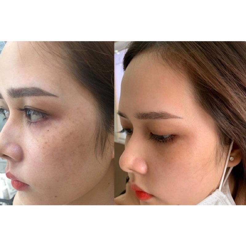 Ủ kén tằm trắng da lskin white Đan Thy