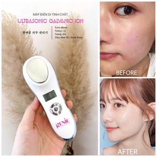 Máy Điện Di Tinh Chất Nóng Lạnh Genie UltraSonic Galvanic Ion New 2021