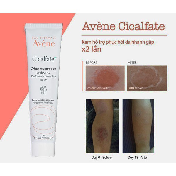 [40ml/100ml] Kem liền sẹo, phục hồi da Avene Cicalfate+ Repairing Protective Cream