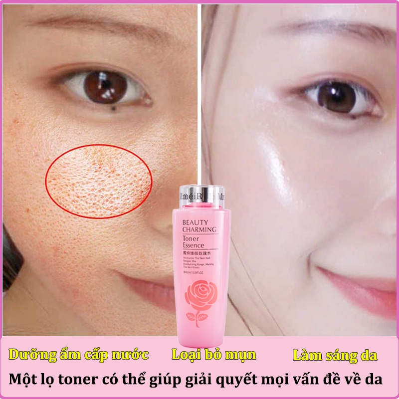Toner dưỡng ẩm tinh chất thu nhỏ lỗ chân lông cấp nước làm trắng dưỡng ẩm loại bỏ mụn cám