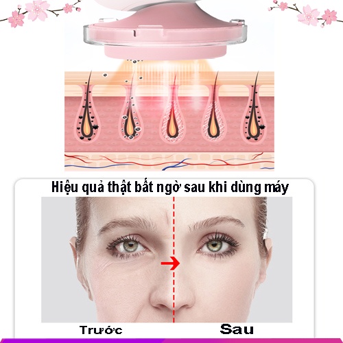 Máy Điện Di Tinh Chất - Đẩy Dưỡng Chất - Tẩy Trang Sạch Sâu Cho Da Mặt