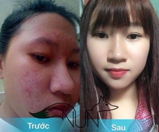 Serum Bạch Đan Dược