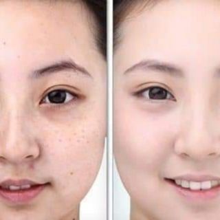 Kem Nền MISTINE 24 Cover All Dropper