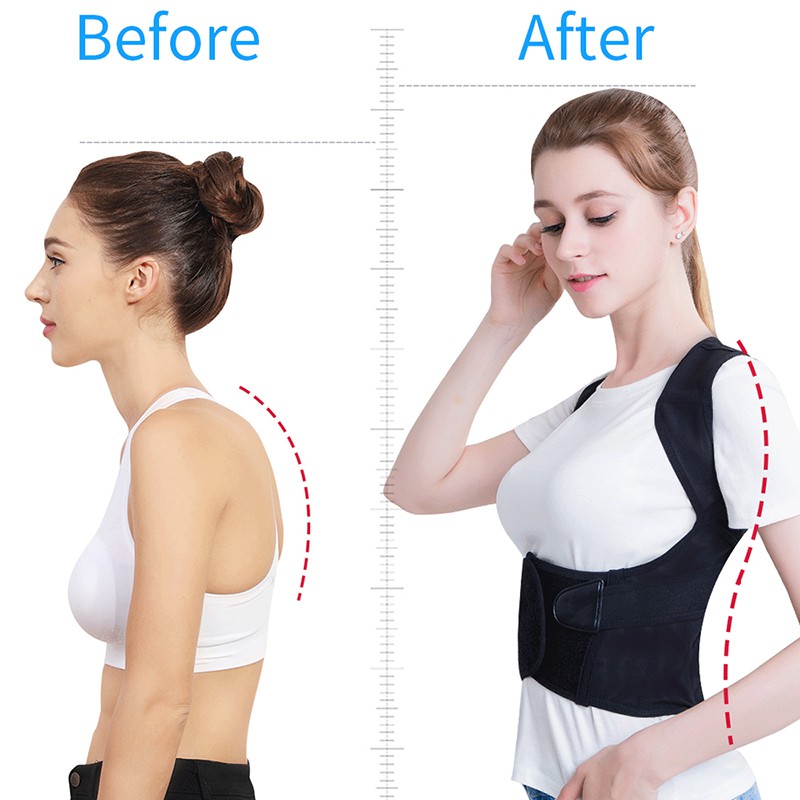 Đai Đeo Junlaikang Hỗ Trợ Điều Chỉnh Tư Thế Lưng Và Vai Cho Nam Và Nữ