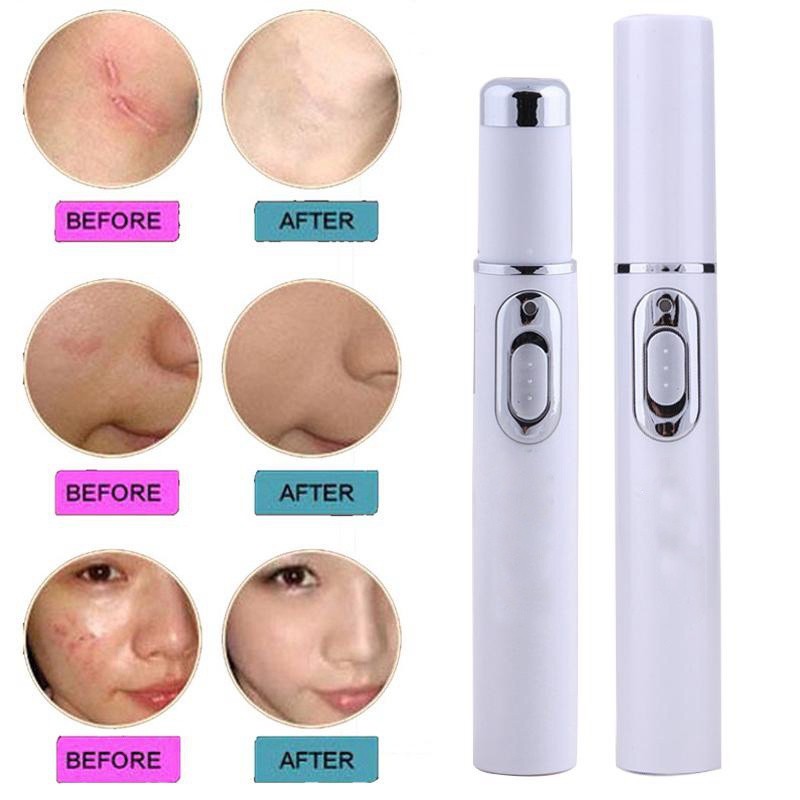 Bút laser xóa mụn sẹo và nếp nhăn bằng ánh sáng xanh bền nhỏ gọn tiện lợi