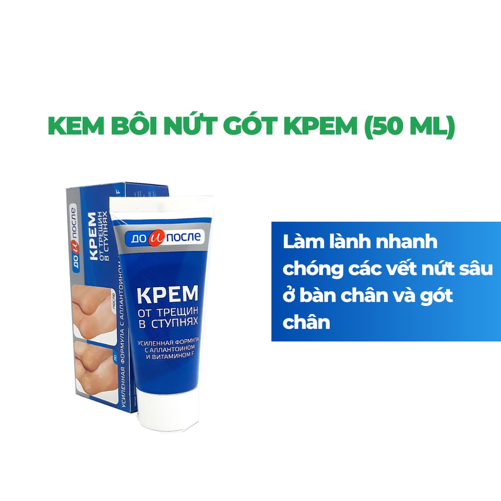 Kem Bôi Nứt Gót Chân Dưỡng Ẩm Kpem Nga 50ml