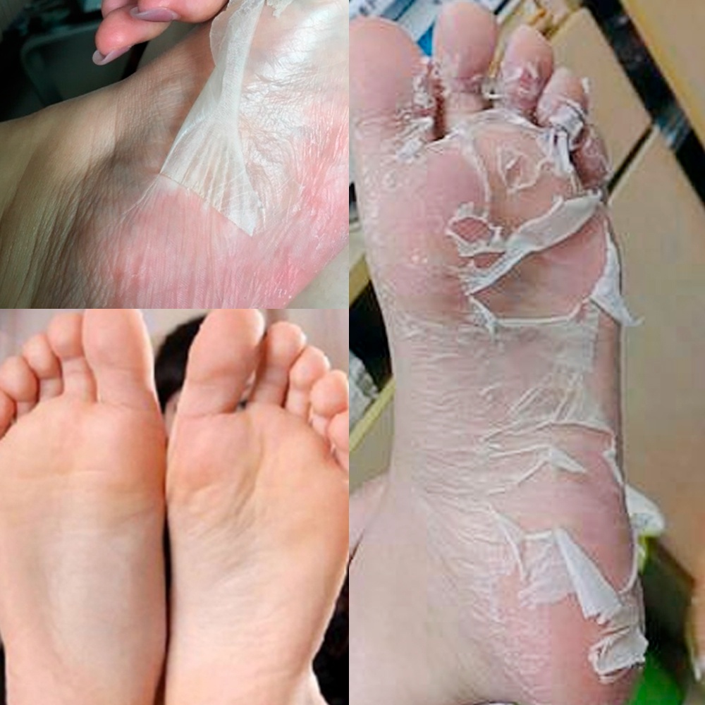 Mặt Nạ Chân Lột Tẩy Tế Bào Chết LANBENA Loại bỏ vết chai da chết Chăm sóc da chân nứt nẻ - Vibesvietnam