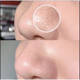 Tẩy da chết face St.Ives