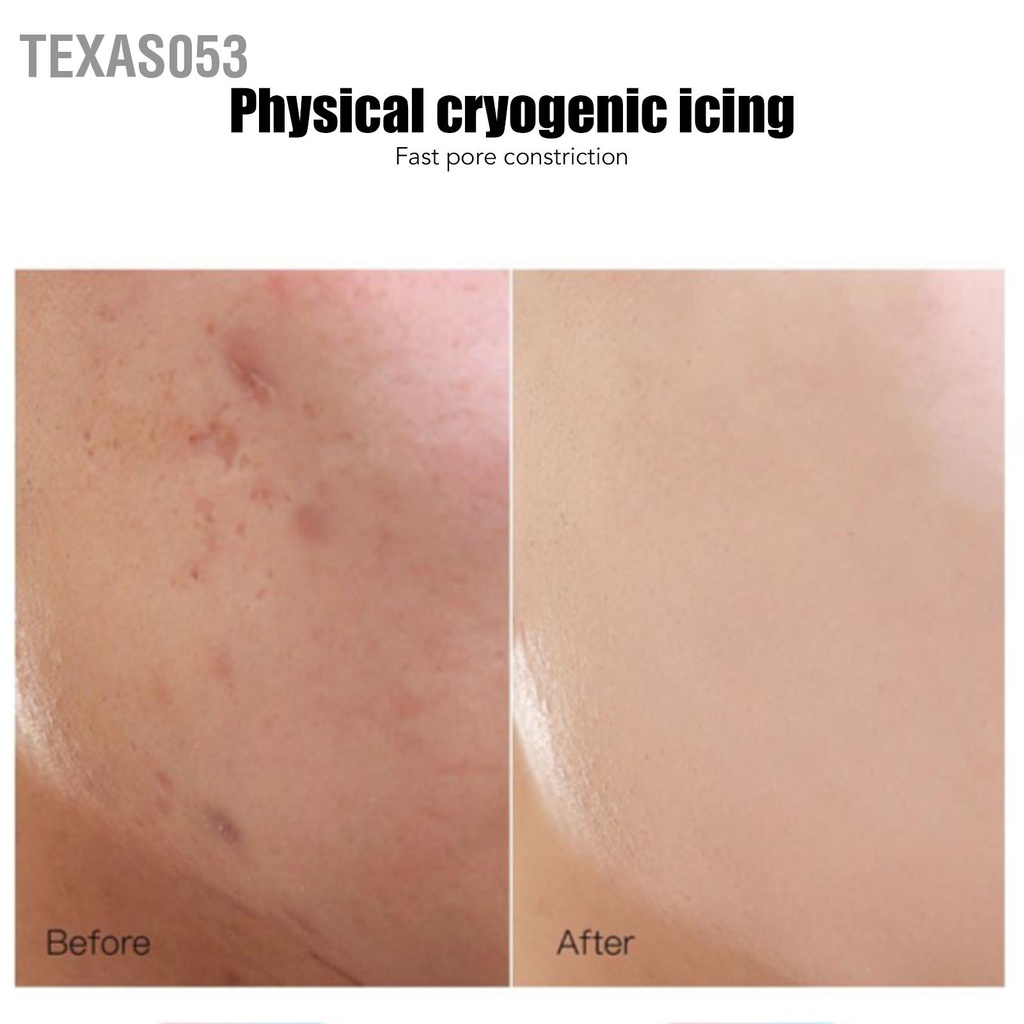 Texas053 Con lăn lạnh Massage mặt bằng đá Làm mát Tăng tốc phục hồi da Mặt con Thu nhỏ lỗ chân lông Trắng