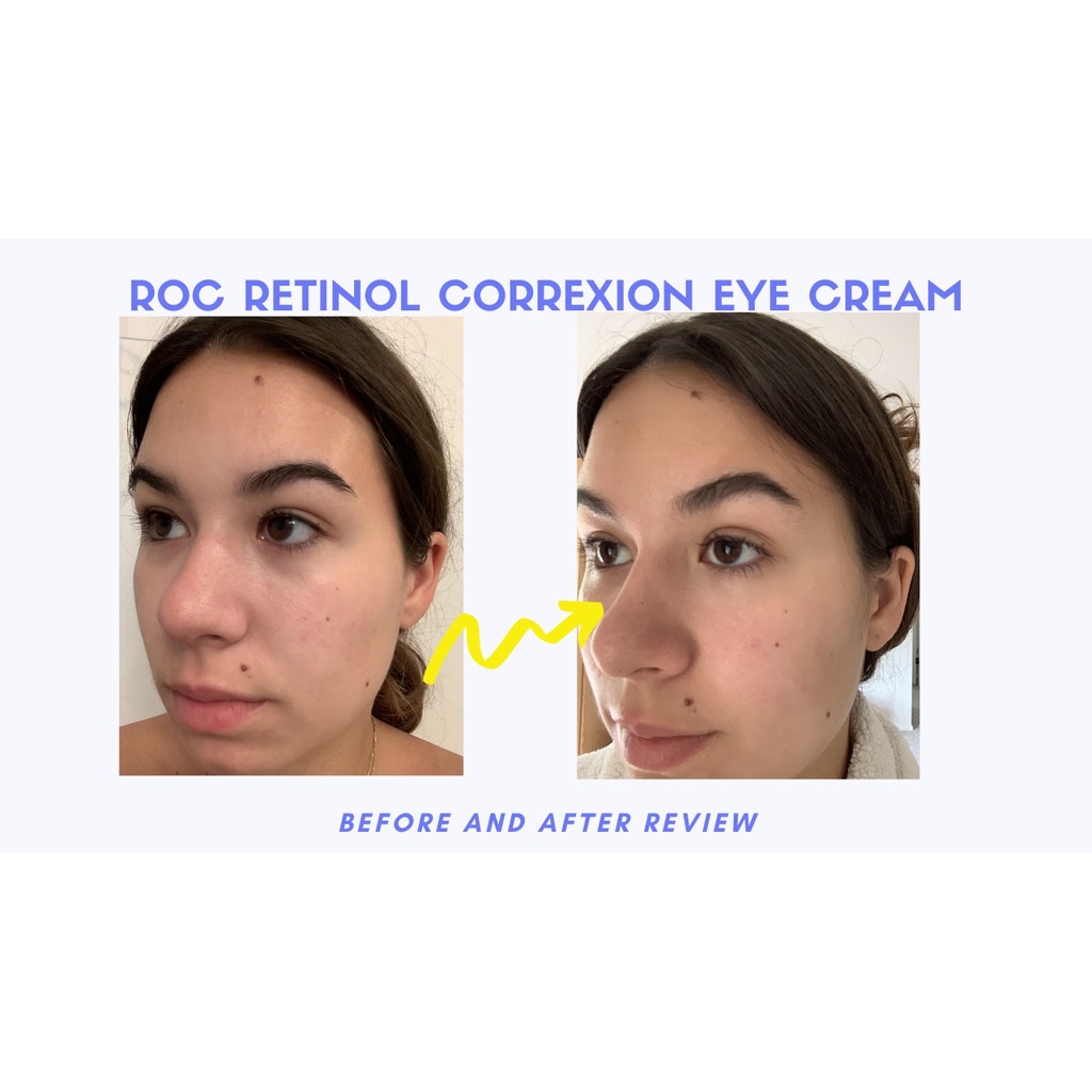 (15ml) Kem Mắt RoC Eye Cream RETINOL CORREXCION Chính Hãng (USA)