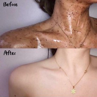 Tẩy da chết quế hồi Nga