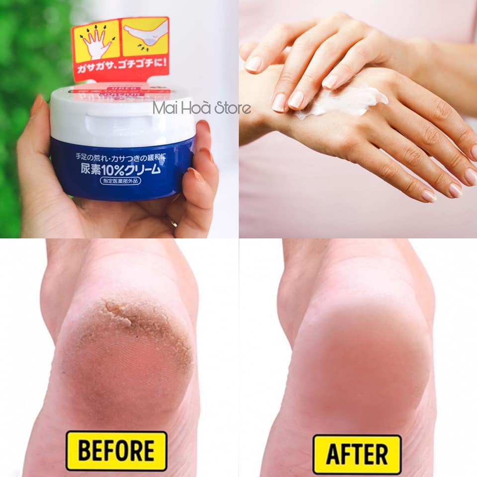 Kem Nứt Nẻ Chân Tay Shiseido Urea 100g Nhật Bản