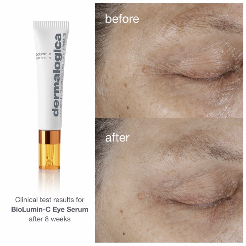 Serum mắt BioLumin-C Eye Serum 6ML