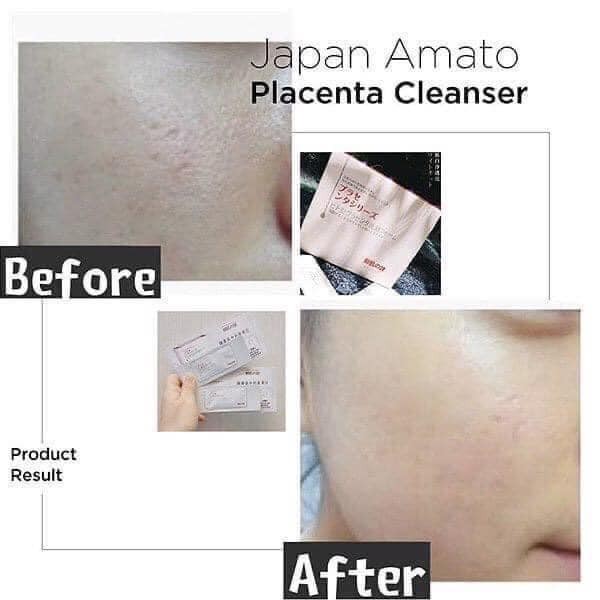 Ủ trắng da nhau thai hộp 50 gói | Thế Giới Skin Care