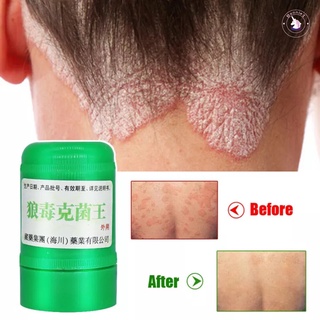 Kem Thảo Dược Y Tế Trung Quốc Kháng Khuẩn Giảm Ngứa Dưỡng Ẩm Chống Nứt Da Tay 12g