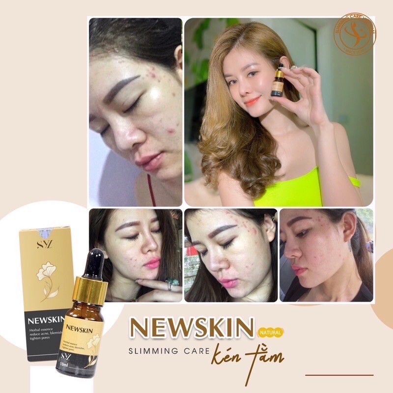 Newskin Dưỡng Da sạch mụn thâm