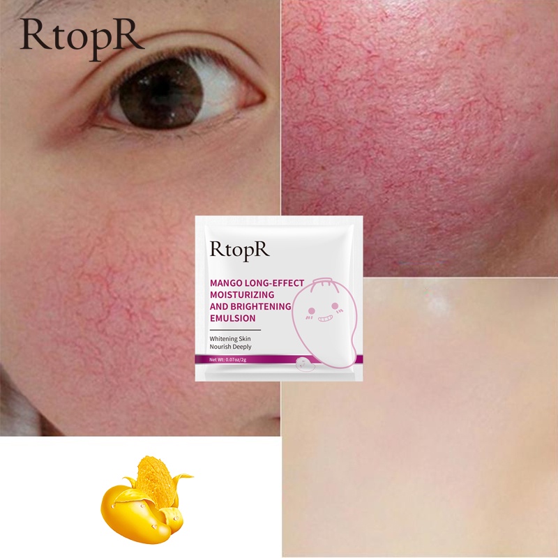 Set 5 tinh chất dưỡng da mặt RTOPR chiết xuất xoài cấp ẩm làm sáng săn chắc da giảm nếp nhăn chống lão hóa lâu trôi