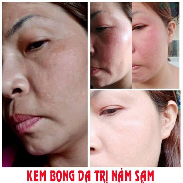 Kem vỗ bong da mặt BEZY ThaiLan