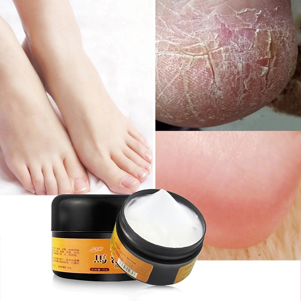 Horse Oil Feet Cream Heel Cream for Athlete's Foot Feet Mask Itch Blisters Anti-chapping Peeling for Foot Care Cream