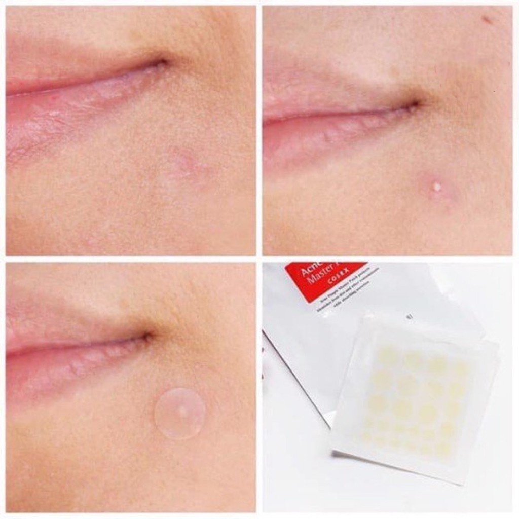 Miếng dán mụn Cosrx Acne Pimple Master Patch 24 miếng màu đỏ