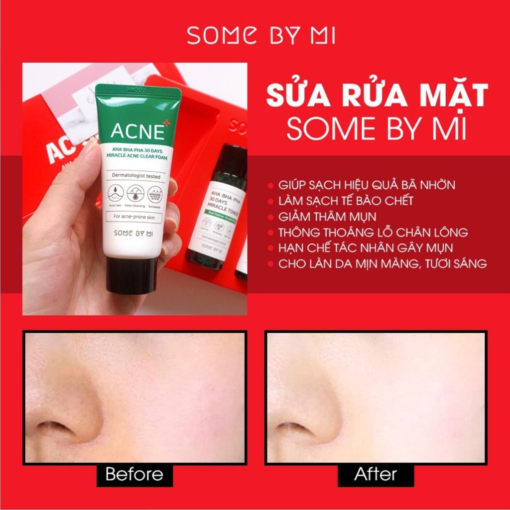 Bộ Kit Giảm Mụn Some By Mi AC SOS AHA BHA PHA 30 Days