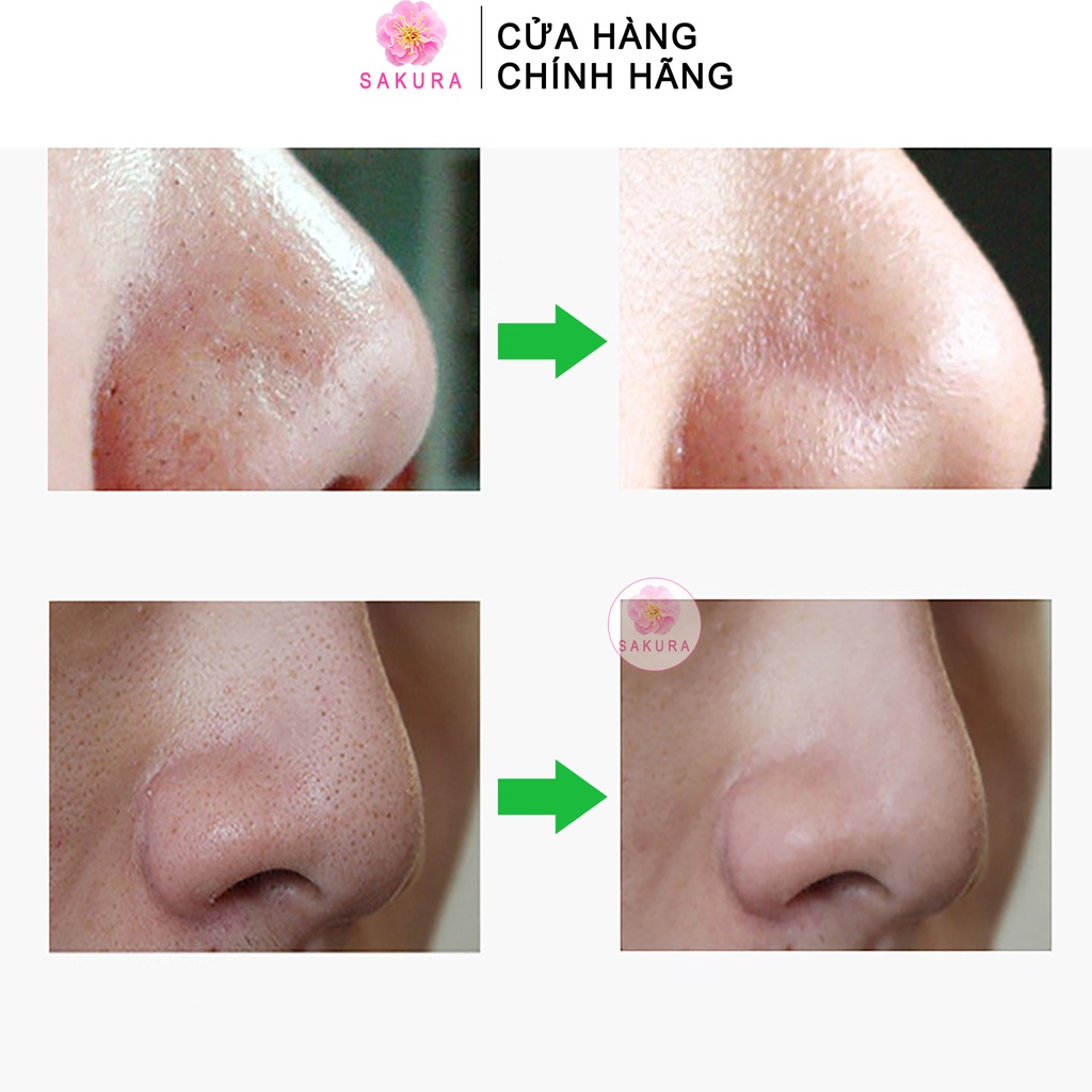 Mặt nạ lột mụn IMAGES Mask chiết xuất than tre hoạt tính lột sạch mụn đầu đen nội địa trung SAKURA 6g