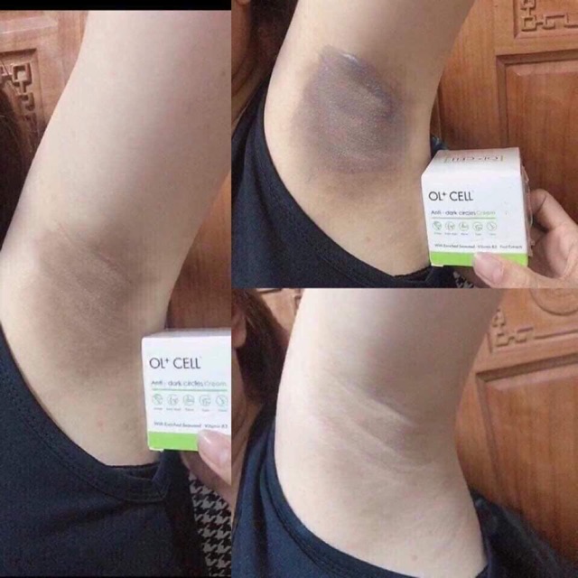 KEM HÚT THÂM NÁCH,NHŨ HOA,BẸN,MÔNG,ĐẦU GỐI...OL+CELL - TMZ SHOP - Thymozin 305 | BigBuy360 - bigbuy360.vn