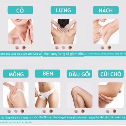 Nakiz | Kem Loại Thâm Mụn MÔNG, LƯNG, NÁCH, BẸN, KHUỶ TAY, ĐẦU GỐI | BigBuy360 - bigbuy360.vn